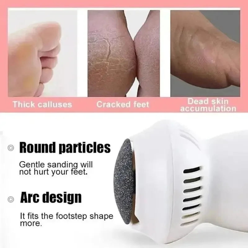Powerful Electric Callus Remover | Ergonomic & Rechargeable Dead Skin Foot Remover 5