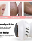 Powerful Electric Callus Remover | Ergonomic & Rechargeable Dead Skin Foot Remover 5